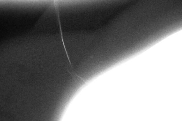 transmission-trauma-12