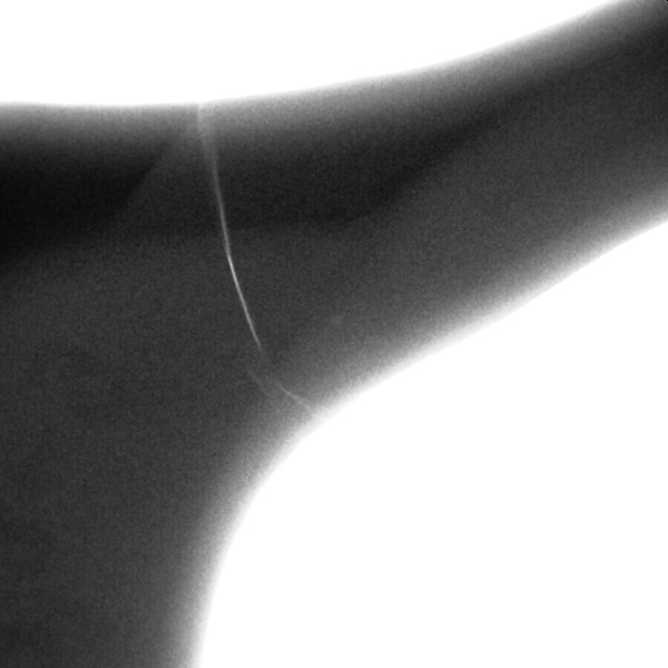 Fork x-ray